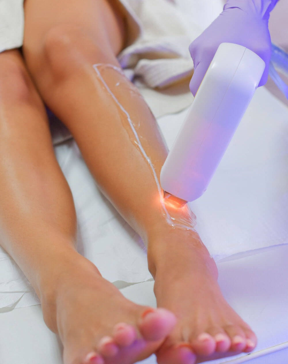 Laser Treatments Integrative Medicine Laser and Aesthetics